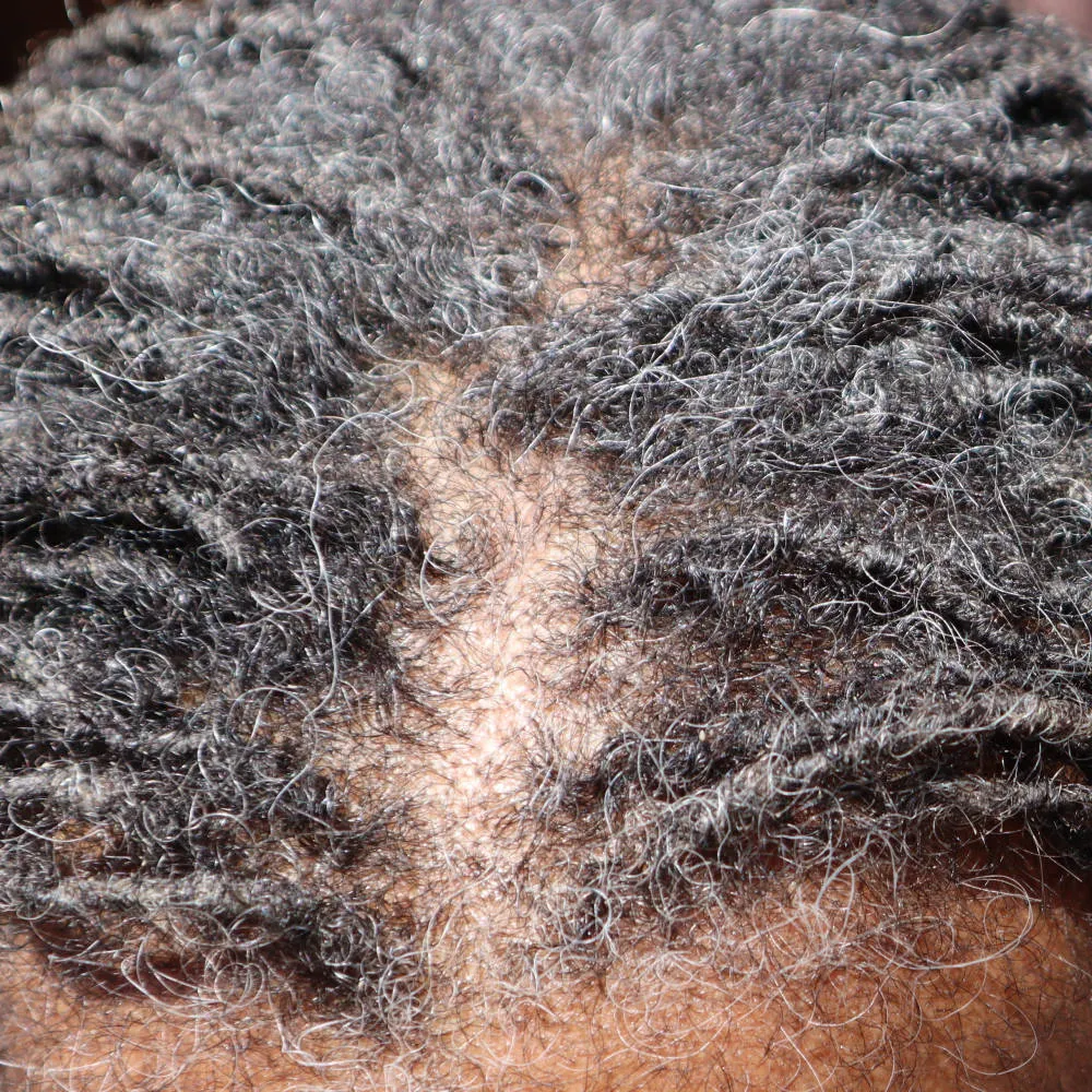 What Naturals Love Hair Growth Serum