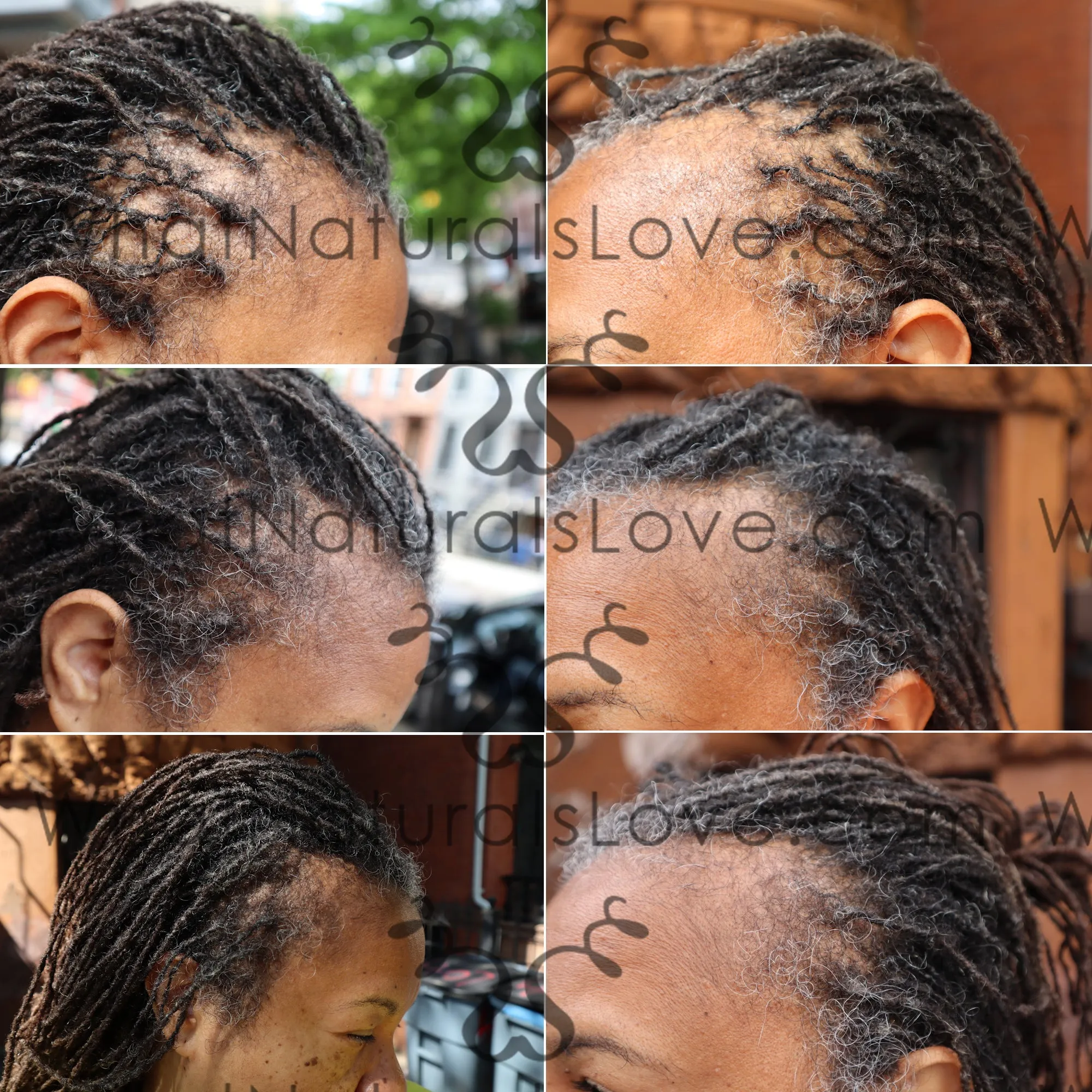 What Naturals Love Hair Growth Serum