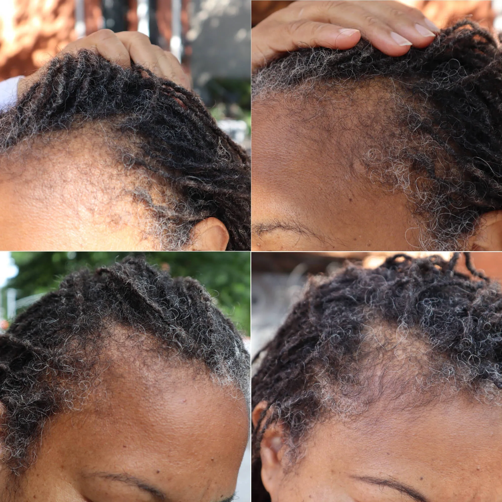What Naturals Love Hair Growth Serum